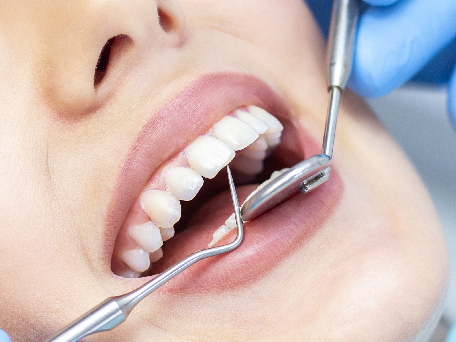How To Choose The Right Dental Treatment?