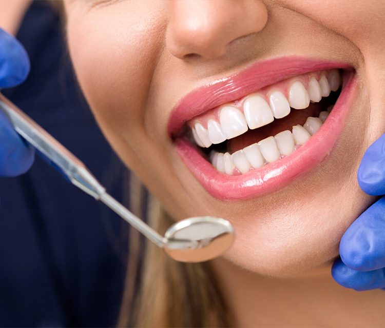 Composite Bonding vs. Veneers in Turkey: Pros and Cons