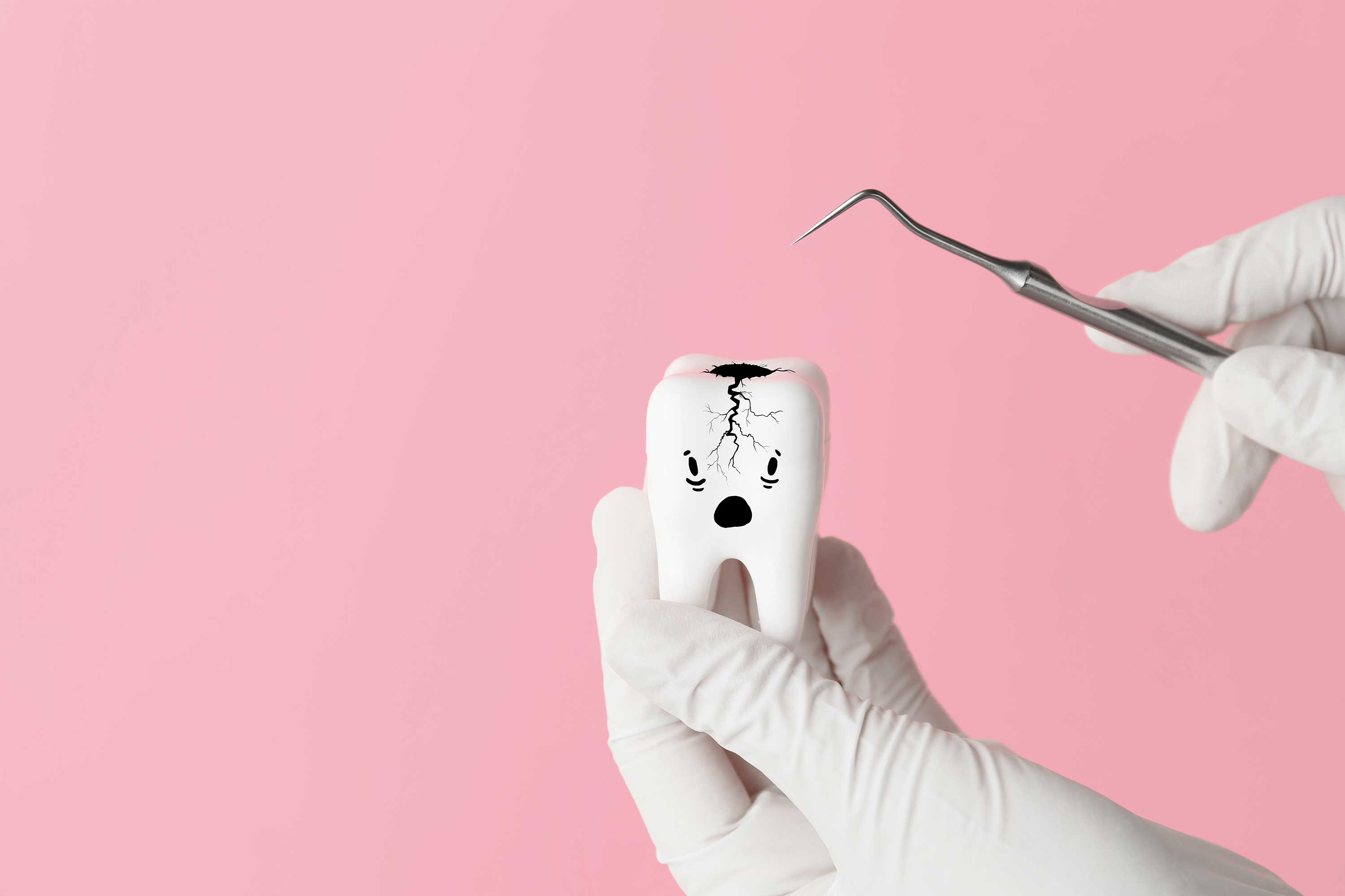 Cracked Tooth Treatment in Turkey: Why Choose GD Smile Studio? | GD Smile Studio