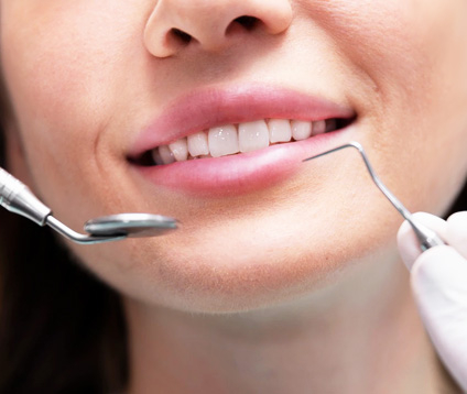 Gum Grafting: Procedure, Benefits, and Recovery Process