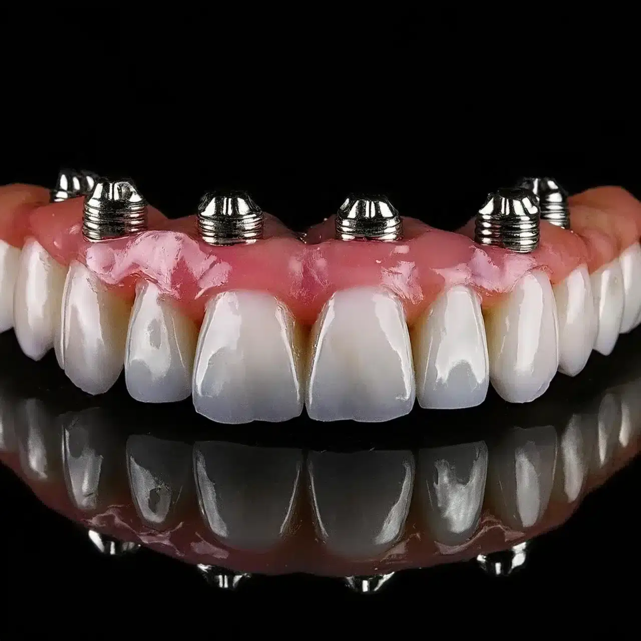 All-on-6 dental implants treatment at GD Smile Studio in Istanbul