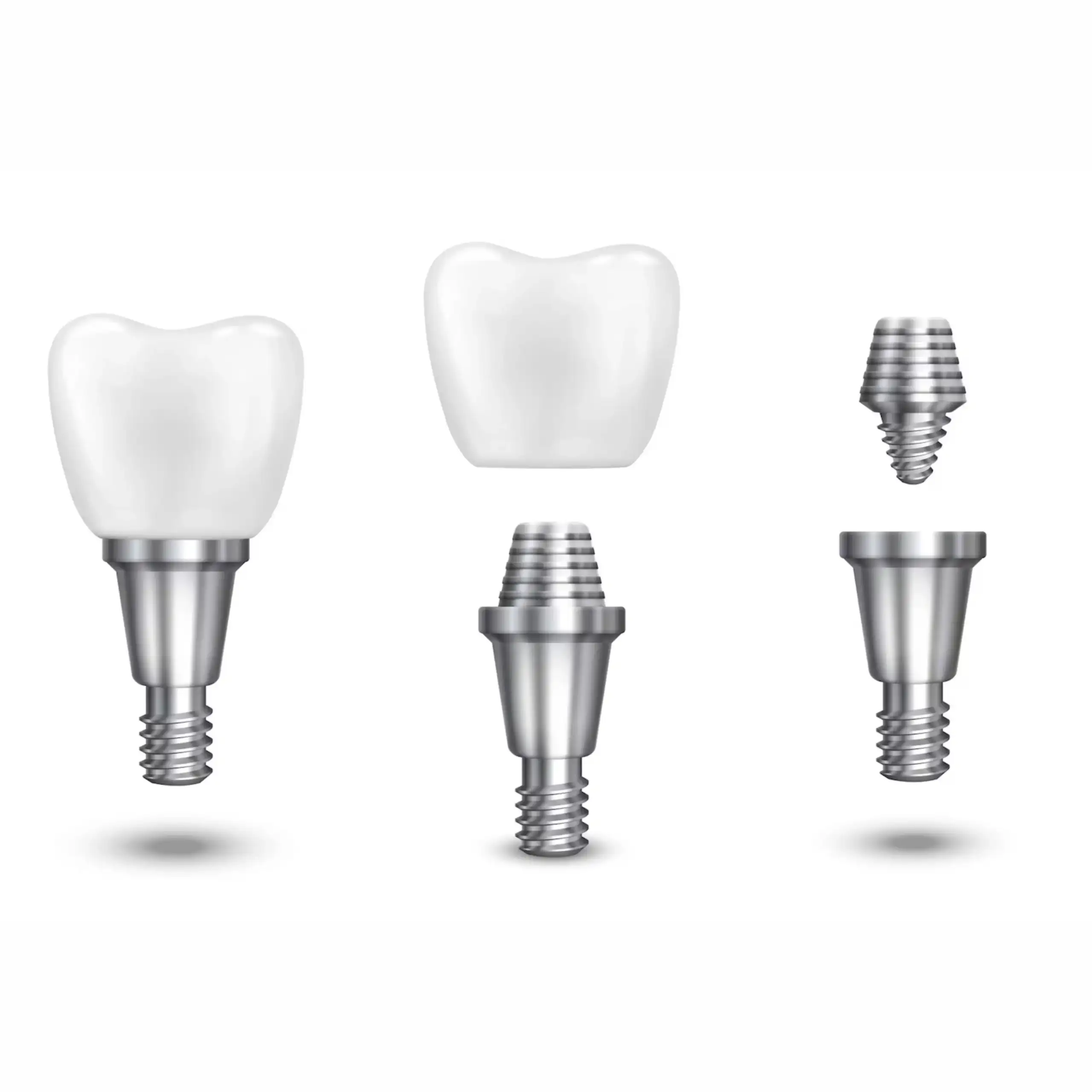 Dental implant treatment at GD Smile Studio in Istanbul