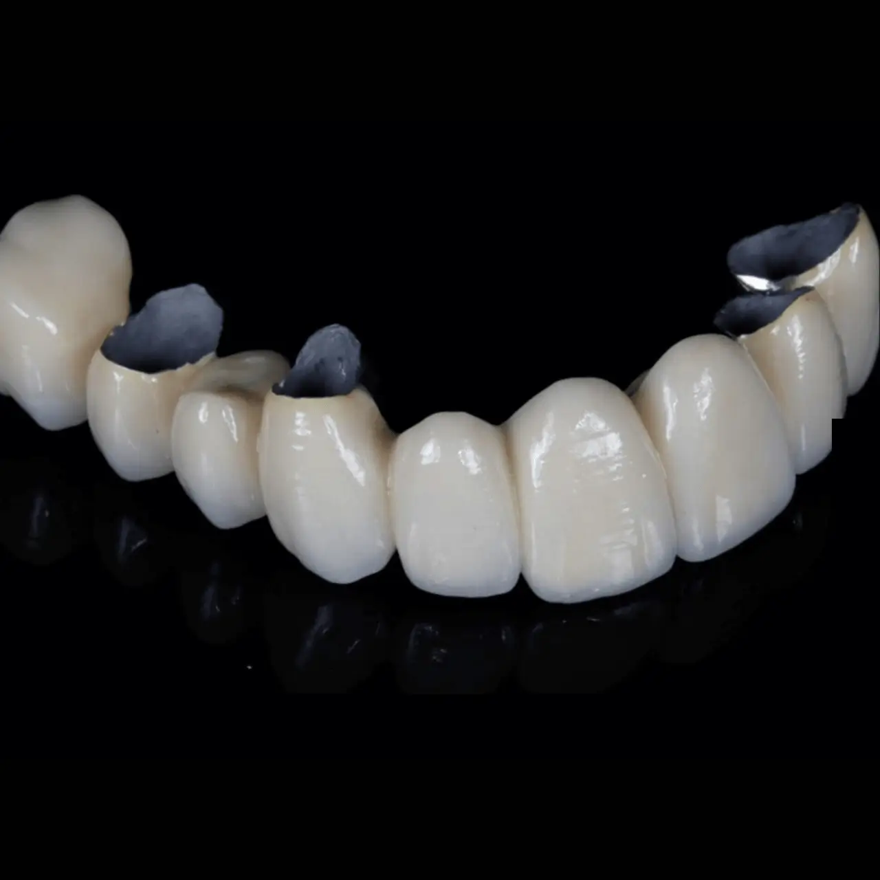 Porcelain crowns at GD Smile Studio in Istanbul