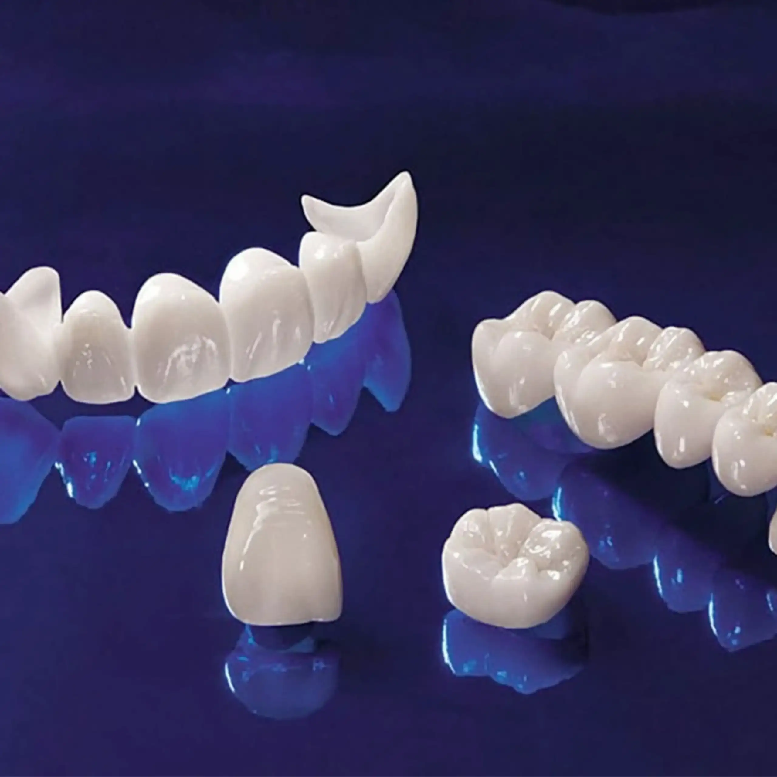 Zirconium crowns at GD Smile Studio in Istanbul